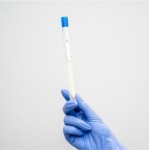 Posiew wymazu z nosa