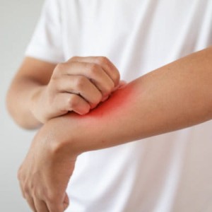 Panel Atopowy (30 alergenów)