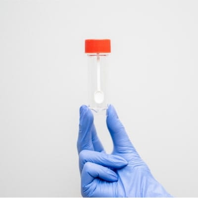 Helicobacter pylori w kale. Badanie wykonuje się u pacjentów z objawami wrzodów żołądka lub dwunastnicy, zapalenia żołądka. Wynik dodatni wskazuje na obecność bakterii w przewodzie pokarmowym