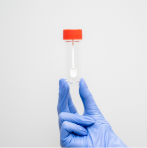 Kał w kierunku toksyn A i B Clostridioides difficile